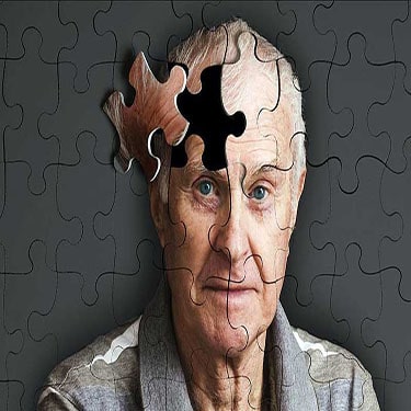 alzheimer-the-elderly