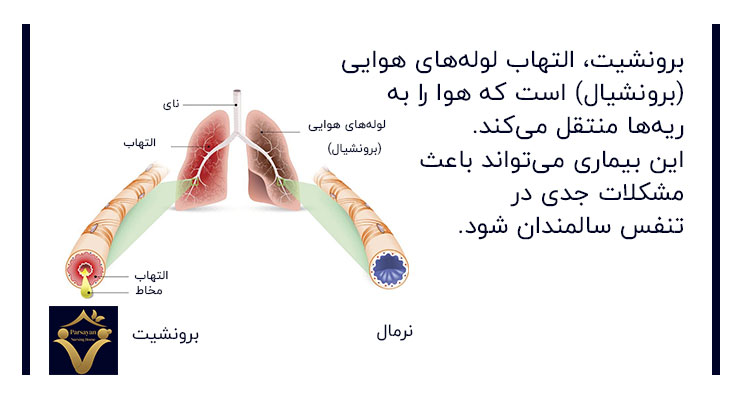 برونشیت