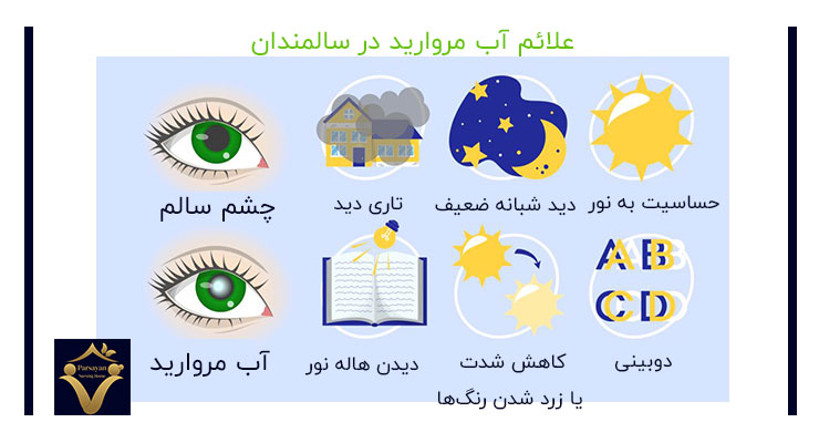 علائم آب مروارید در سالمندان